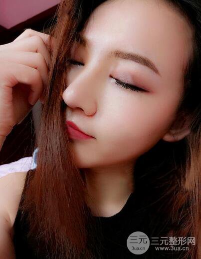 耳軟骨隆鼻全過程及術(shù)后果分享