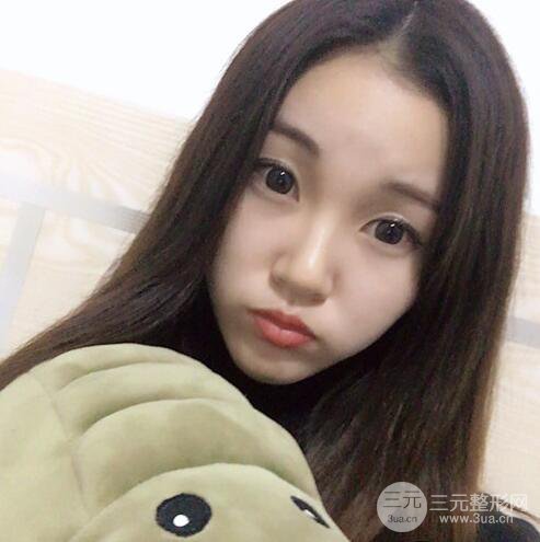 下頜角磨骨整形全過程分享，附上術后恢復照片~