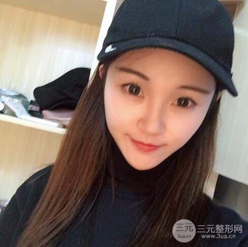 下頜角磨骨整形全過程分享，附上術后恢復照片~