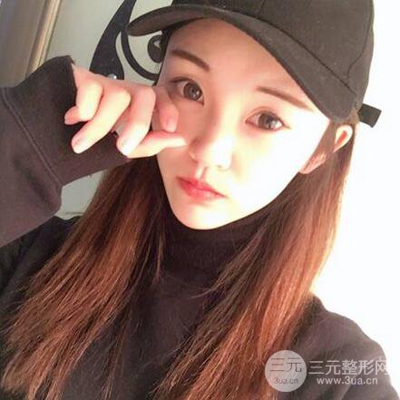 下頜角磨骨整形全過程分享，附上術后恢復照片~