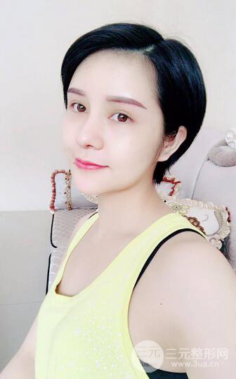 做了隆鼻整形隆鼻之后,短發(fā)女孩也可以性感!