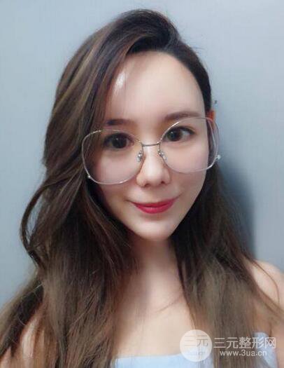 全臉自體脂肪填充,填充不飽滿還可以瘦臉_真人案例