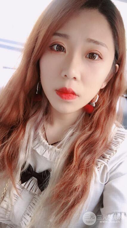 無錫菲尚徐火旺雙眼皮案例