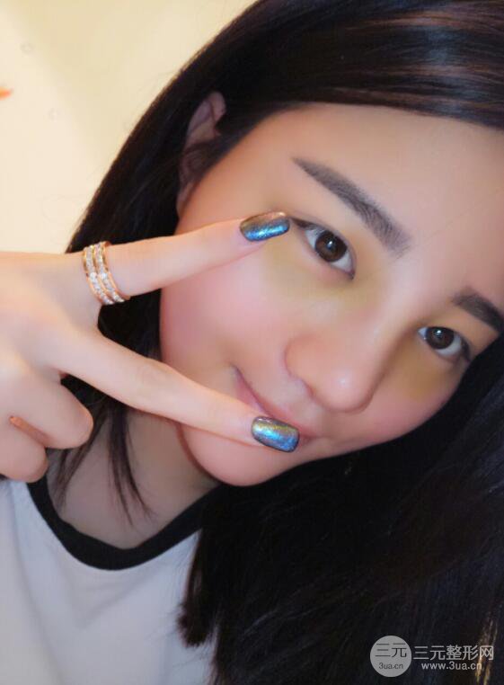 長(zhǎng)沙亞韓整形醫(yī)院鄭京湘假體隆鼻