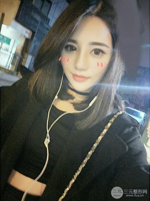 長(zhǎng)沙亞韓整形醫(yī)院鄭京湘假體隆鼻