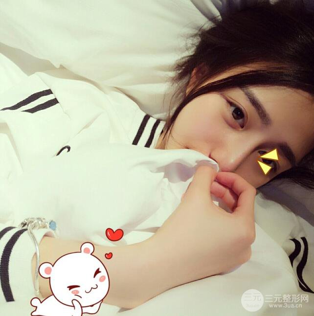 長(zhǎng)沙亞韓整形醫(yī)院鄭京湘假體隆鼻