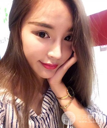 模特做隆鼻整形真實日記分享,附上恢復(fù)過程圖