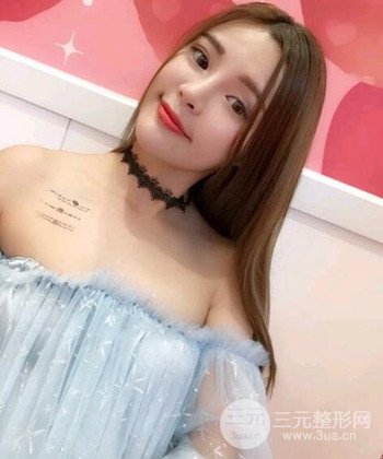 模特做隆鼻整形真實日記分享,附上恢復(fù)過程圖