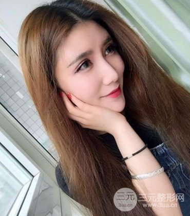 網(wǎng)絡(luò)主播做自體脂肪豐太陽(yáng)穴真實(shí)案例分享,果杠杠的