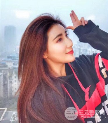 網(wǎng)絡(luò)主播做自體脂肪豐太陽(yáng)穴真實(shí)案例分享,果杠杠的