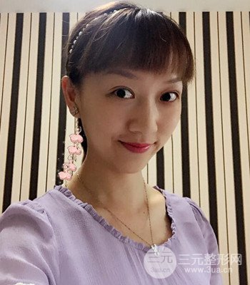 北京雙眼皮失敗修復(fù)手術(shù)日記分享，附上前后對(duì)比照片