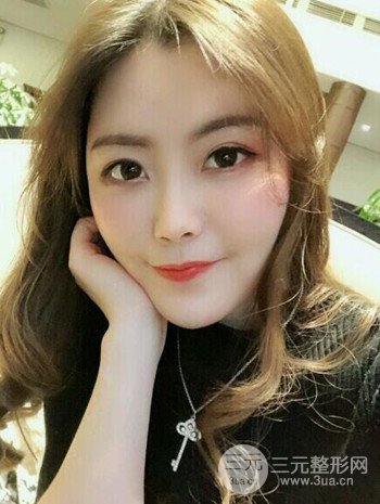 主播在深圳美臣做了自體脂肪全臉填充手術(shù)日記分享