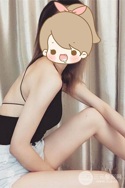 梨型身材做了大腿吸脂之后果超明X，吸脂恢復(fù)過程分享