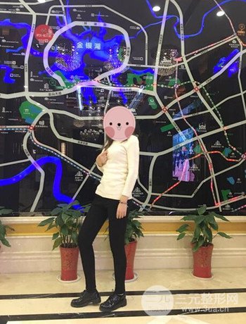 吸脂瘦大腿手術(shù)經(jīng)歷分享,纖細(xì)雙腿不再是夢
