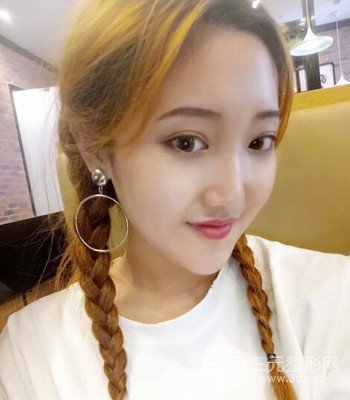 終于做了下頜角整形,分享術(shù)后恢復(fù)果