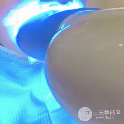做了牙齒冷光美白果很棒，綻放美麗笑容