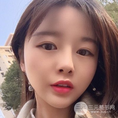 做了牙齒冷光美白果很棒，綻放美麗笑容