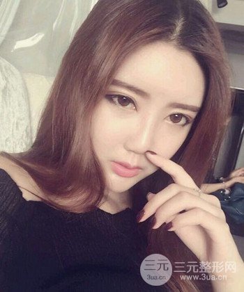 全臉自體脂肪填充手術(shù)日記分享，改良臉型年輕十歲