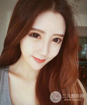 全臉自體脂肪填充手術(shù)日記分享，改良臉型年輕十歲