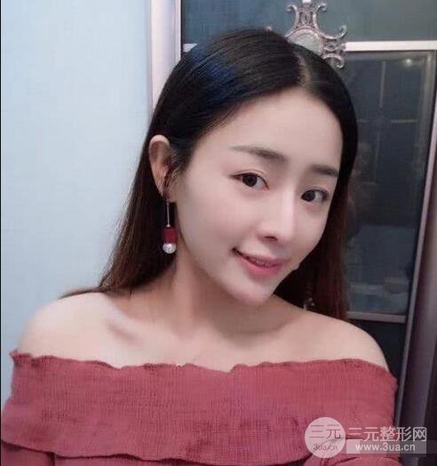 吉林銘醫(yī)李紅肋骨隆鼻整形前后對不圖果恢復(fù)心情小札