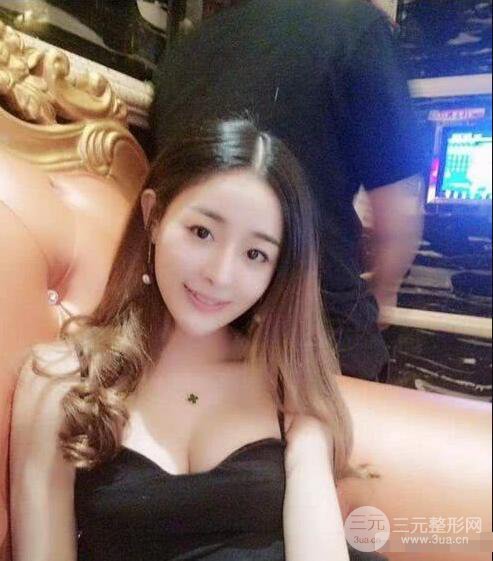 吉林銘醫(yī)李紅肋骨隆鼻整形前后對不圖果恢復(fù)心情小札