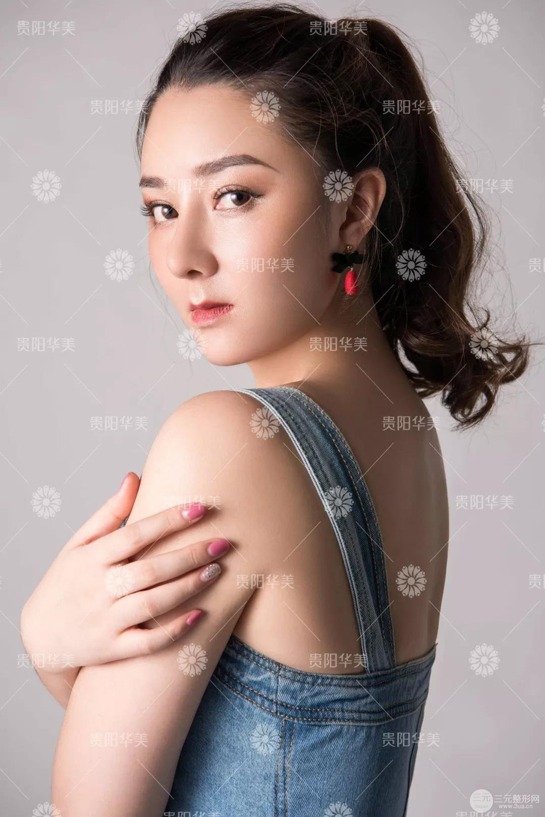 貴陽華美郭宗科全切雙眼皮+假體隆鼻案例前后對比圖 華美員工全臉整形實錄