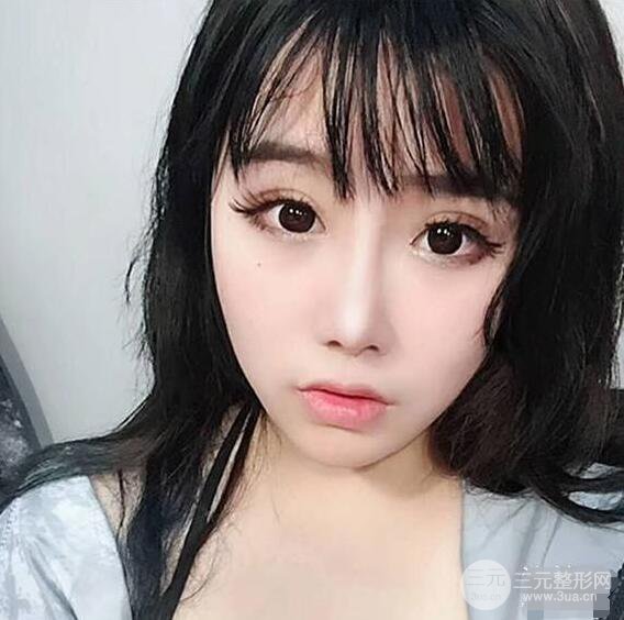 合肥壹加壹甘泉涌軟骨隆鼻前后對比圖|內附真人案例恢復前過程