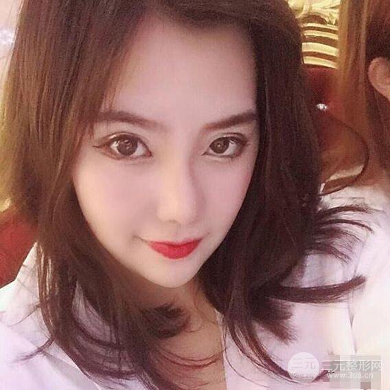 合肥壹加壹甘泉涌軟骨隆鼻前后對比圖|內附真人案例恢復前過程