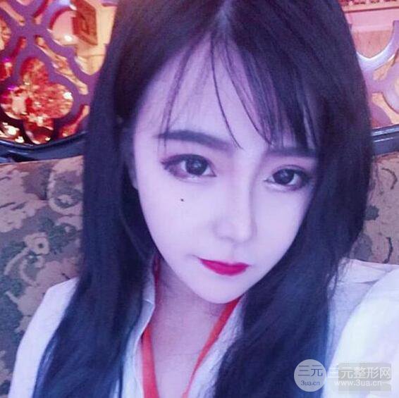 合肥壹加壹甘泉涌軟骨隆鼻前后對比圖|內附真人案例恢復前過程