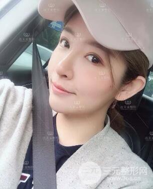 南京連天美整形周長(zhǎng)兵隆鼻整形真人案例前后對(duì)比圖|內(nèi)附恢復(fù)過(guò)程心情日扎