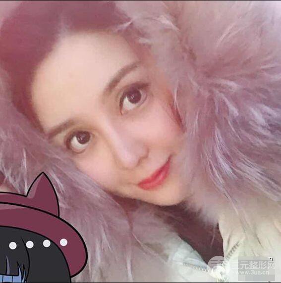 昆明吳氏嘉美李明硅膠隆鼻前后對(duì)比圖恢復(fù)心情小札