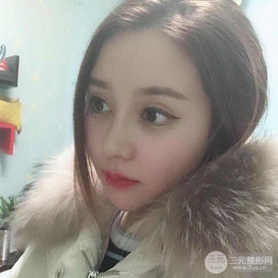 昆明吳氏嘉美李明硅膠隆鼻前后對(duì)比圖恢復(fù)心情小札