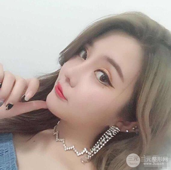 昆明吳氏嘉美李明硅膠隆鼻前后對(duì)比圖恢復(fù)心情小札