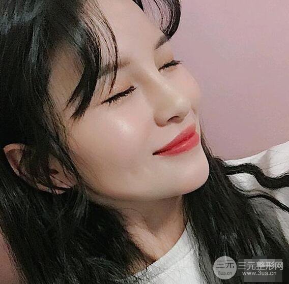 成都華西醫(yī)院整形美容科卿勇隆鼻整形前后對比圖恢復(fù)心情小札