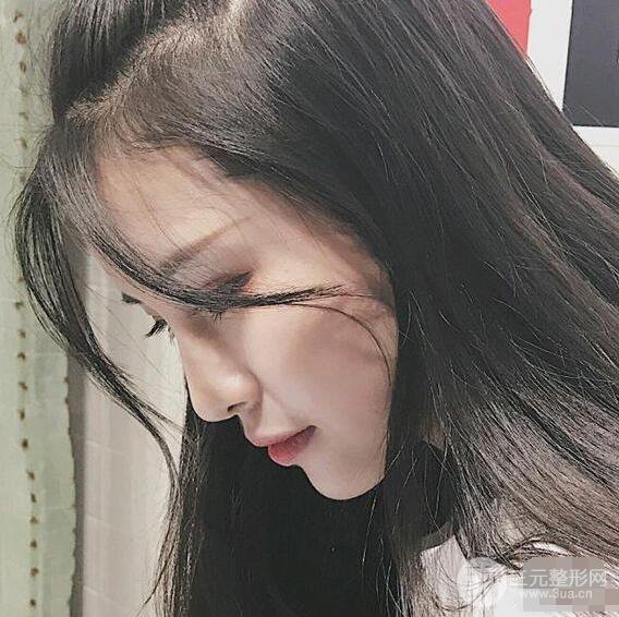 成都華西醫(yī)院整形美容科卿勇隆鼻整形前后對比圖恢復(fù)心情小札