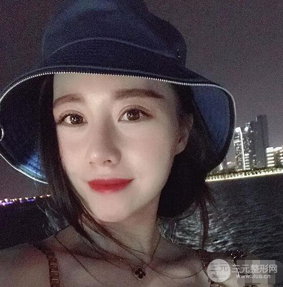 北京聯(lián)合麗格吳焱秋耳軟骨隆鼻前后對比圖|塌鼻子的救星