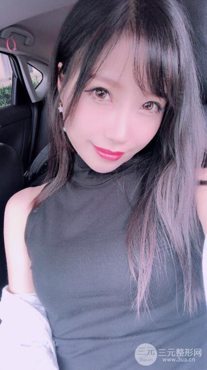 昆明華美美萊楊繼紅肋軟骨隆鼻前后對(duì)比圖恢復(fù)手札