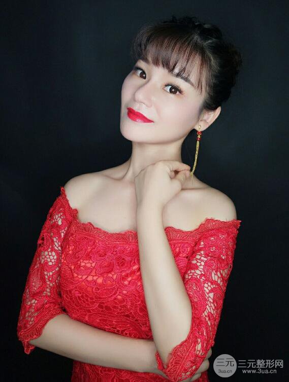 廈門修志夫隆鼻整形前后對比圖真人案例恢復(fù)小札