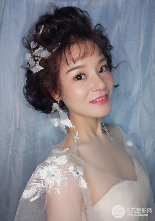 廈門修志夫隆鼻整形前后對比圖真人案例恢復(fù)小札