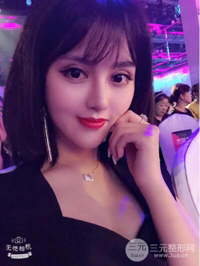 常州施爾美廉鋒自體脂肪豐臉對照圖案例心情日扎