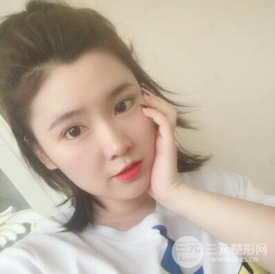 貴陽美萊梁潔芭比媚雙眼皮多項整形前后對比圖恢復心情小札