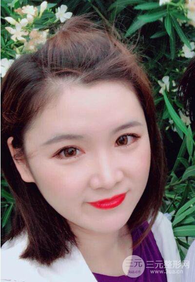 貴陽美萊梁潔芭比媚雙眼皮多項整形前后對比圖恢復心情小札