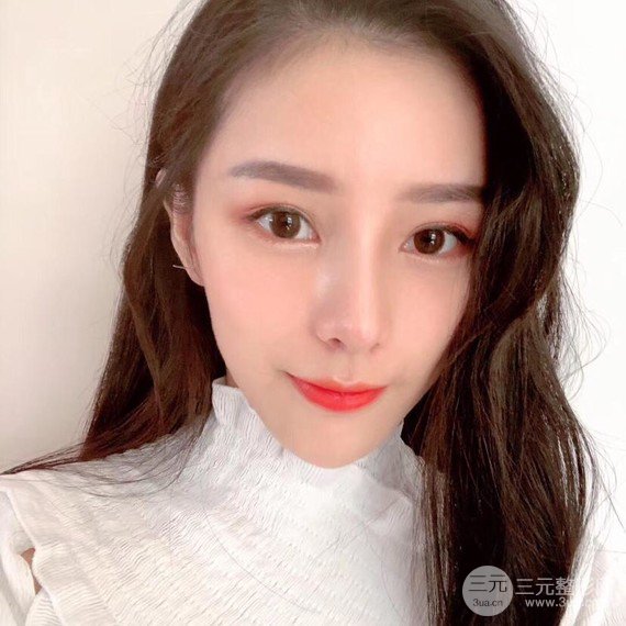 【隆鼻整形+進口假體+耳軟骨墊鼻尖+鼻頭鼻翼縮小+鼻尖延長】綜合改良！