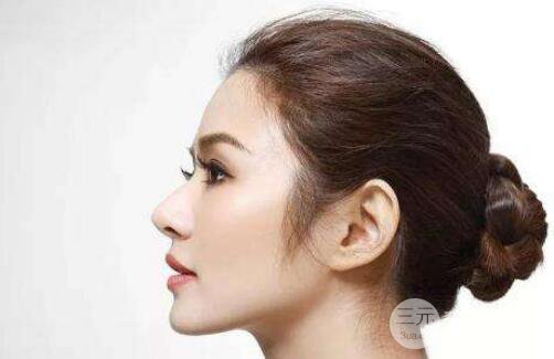 成都自體耳軟骨隆鼻果怎么樣?果好不好？