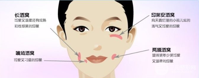 酒窩成形術(shù)