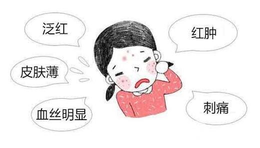 怎么樣可以去掉紅血絲