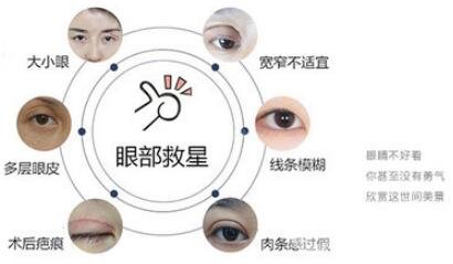 切開雙眼皮手術(shù)優(yōu)點 適合哪些人