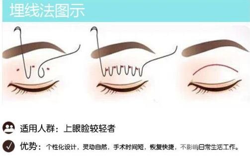 埋線后的果咋樣?