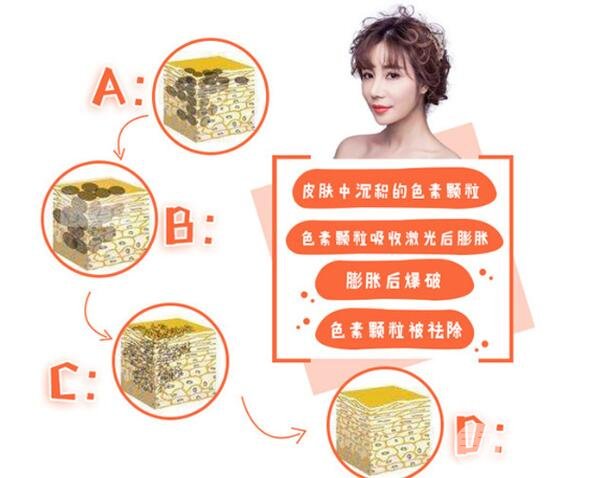 黑臉娃娃價格與自身皮膚有關(guān)