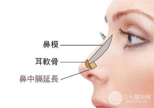鼻部綜合整形價(jià)格多少錢 主要受3點(diǎn)因素影響~